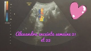 Alexandra enceinte  semaines 21 et 22 [upl. by Yob736]