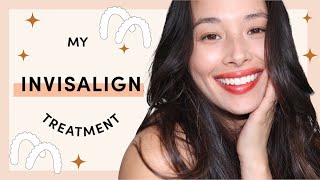 My Invisalign Journey  What To Expect  Aja Dang [upl. by Ahrens]