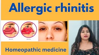 Allergic rhinitis treatment  Allergic rhinitis symptomscauses amp homeopathic medicine in hindi [upl. by Ahsenyt60]