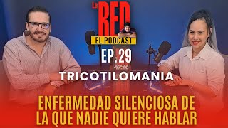 TRICOTILOMANIA Enfermedad silenciosa de la que nadie quiere hablar  Karen Iredy Ep29 [upl. by Ivad]