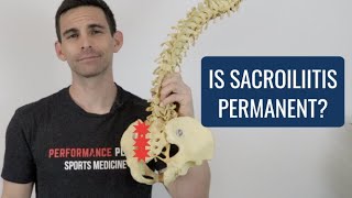 Is Sacroiliitis Permanent [upl. by Eanert519]