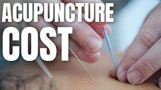 How Much Does Acupuncture Cost [upl. by Kleeman882]