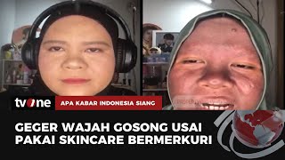 Cerita Nur Sha Wajah Gosong Terdampak Krim Merkuri  AKIS tvOne [upl. by Bevus]