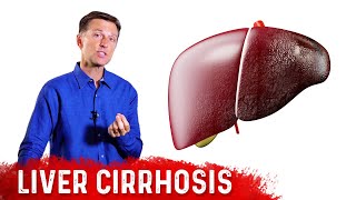 Is Liver Cirrhosis Reversible  Fibrosis vs Cirrhosis – DrBerg [upl. by Alix]