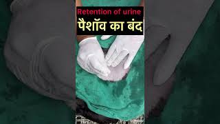 Retention of urine l dr Umar khan [upl. by Popele]