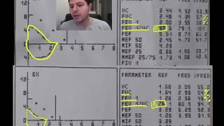 Spirometrie 5  exemple DVR disfunctie ventilatorie restrictiva [upl. by Yggep]