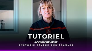 Tutoriel accouchement  dystocie sévère des épaules [upl. by Irbmac]