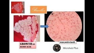 Bacillus bacillus colony on blood agar Gram stain Gram positive bacilli [upl. by Fidellia]