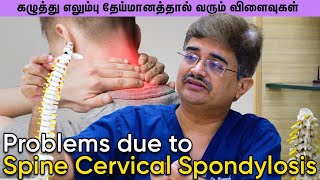 Problems due to Spine Cervical Spondylosis DrRoopesh Kumar [upl. by Halverson]