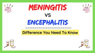 Meningitis and encephalitis difference causes symptoms treatment pathology made easy [upl. by Eoz]