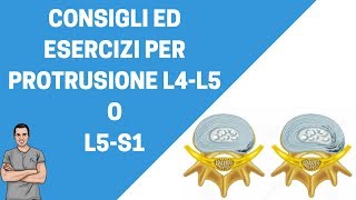 Consigli ed esercizi per protrusione L4L5 o L5S1 [upl. by Dauf395]