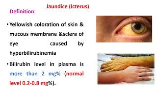 Bile Pigments And Jaundice [upl. by Assenav]