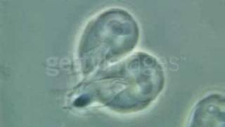 Giardia Lamblia [upl. by Esinel]