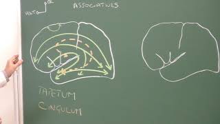 Neuroanatomie 9 substance blanche cérébrale ventricules latéraux Lateral ventricles [upl. by Rissa]