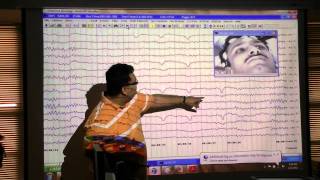 An EEG introduction [upl. by Xanthe]