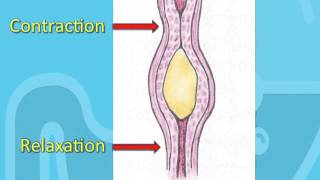 Swallowing Disorders and Achalasia [upl. by Yarvis]