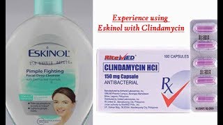 2019 Acne Story Part 1 EXPERIENCE Eskinol with dalacin cclindamycin [upl. by Hulton]