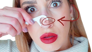 One Weird Blackhead and Whitehead Removal Hack That Actually Works  Hack My Life 12 [upl. by Ennylhsa]