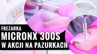 Ściągam masę i opracowuję skórki frezarką MicroNX 300S  Drillo [upl. by Penney479]