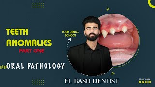 developmental anomalies  teeth anomalies 1 oral pathology عزت شومان [upl. by Burne874]