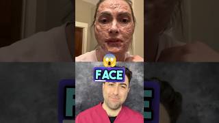 What’s gone WRONG with this gelatin face mask [upl. by Hniht553]