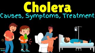 Cholera – Symptoms Causes Pathogenesis Diagnosis Treatment Complications Prevention amp Vaccine [upl. by Tamberg856]