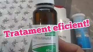 Tratament incredibil si rapid contra caderii parului Incredible and fast hair loss treatment [upl. by Ocko124]