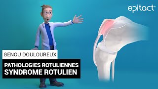 Syndrome Rotulien  Explication  EPITACT [upl. by Ursulette]