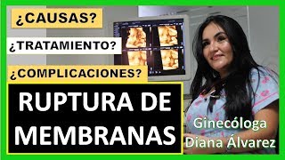 RUPTURA DE MEMBRANAS POR GINECOLOGA DIANA ALVAREZ [upl. by Artemisa47]