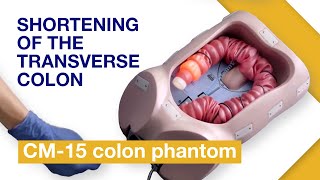 Basic Techniques of Colonoscope Insertion  Exercise 4 Shortening of the transverse colon [upl. by Eidson]