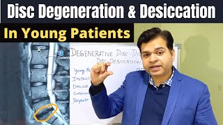 Disc Degeneration L5 S1 Disc Desiccation Disc Degeneration Causes DDDDegenerative Disc Treatment [upl. by Aticilef70]