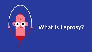 What is Leprosy Chronic Infectious Disease [upl. by Andreana]