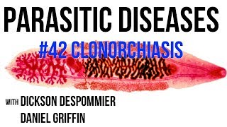 Parasitic Diseases Lectures 42 Clonorchiasis [upl. by Yv]