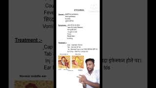 Otitis medi treatment [upl. by Ahsirtak]