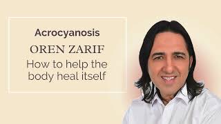 Oren Zarif  Acrocyanosis  wwworenzarifenergycom [upl. by Novled]