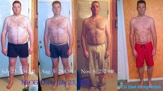 Guys hCG Diet Results for Men  110lb Weight Loss  Episode 9 hCG Diet Interviews [upl. by Vacuva]