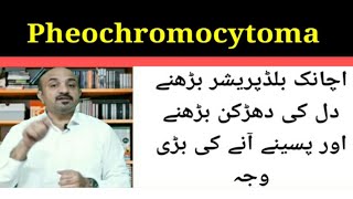 Pheochromocytomawhat is thiswhat are its symptoms and how it is diagnosed and managed [upl. by Navap]