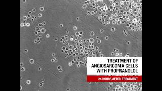 Treatment of Angiosarcoma Cells With Propranolol [upl. by Barnett560]