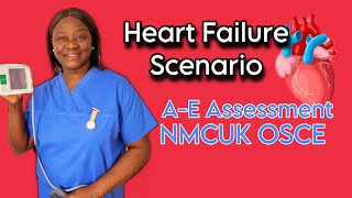 Heart Failure Follow this guide to pass the A to EAssessmentnmcuk osce heartfailure assess [upl. by Anihcak]