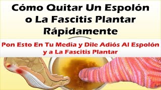 Pon Esto En Tu Media y Dile Adiós Al Espolon y a La Fascitis Plantar Como Quitar Un Espolon Rapido [upl. by Steffie]