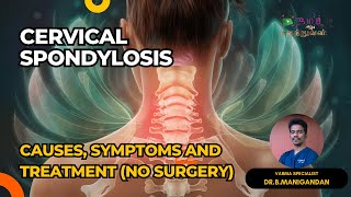 கழுத்து வலி காரணம்  CERVICAL SPONDYLOSIS Treatment NO SURGERY thamizhmaruthuvan cervicalpain [upl. by Alrick]