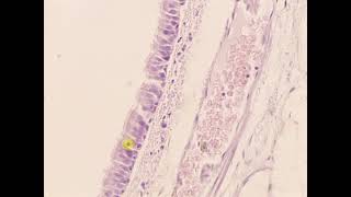 Pseudostratified columnar epithelium with cilia Trachea [upl. by Verne]