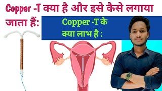 Copper T insertion IUDCopper T क्या है और इसे कैसे लगाया जाता हैं Copper T को कब लगाना चाहिए [upl. by Evyn]