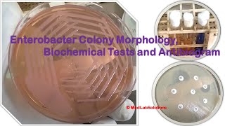 Enterobacter Colony Morphology Biochemical Tests and Antibiogram Demonstration [upl. by Cralg735]