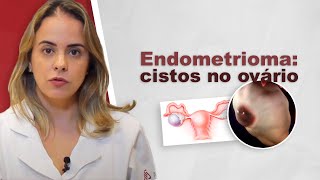 Endometrioma cistos de endometriose no ovário [upl. by Aicatsan]