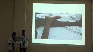 Case Presentation  Myelomeningocele causing AKI  K Moulika Kamineni IMS  OSMECON 2019 [upl. by Dez]