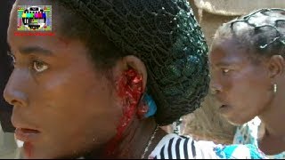 Elle perd une oreille pour avoir réclamé ses droits au Togo de Faure Gnassingbé 762013 [upl. by Willcox252]