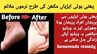 Cracked heels cream at home Remedy for cracked heelsphati hui airiyon ka ilaj [upl. by Hillhouse]