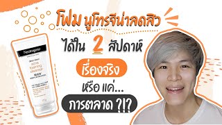 โฟมนูโทรจีน่าลดสิวได้ใน 2 สัปดาห์ เรื่องจริง หรือ แค่ การตลาด [upl. by Ablem388]