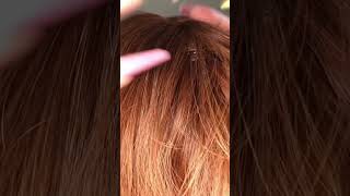 Asmr scratching asmr asmrscratching asmrsounds asmrvideos asmrscalpcheck longnails [upl. by Merrielle]